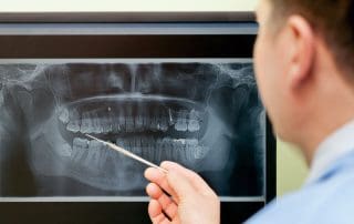 Dentist reviewing dental X-rays on medical screen.