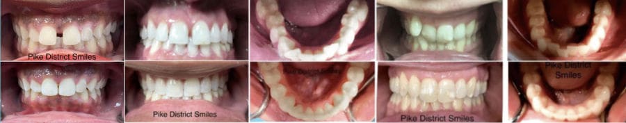 A cyclist poses confidently with a bright smile, showcasing his strong white teeth. This image highlights the importance of dental health for an active lifestyle, reflecting the positive impact of Pike District Smiles' dental care on patients' overall well-being.