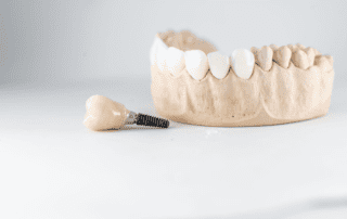 Dental teeth dummy placed on the table, one tooth is detached with an implant attached to it, highlighting dental implant importance.
