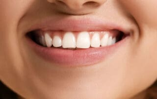 Woman smiling, showcasing her bright white teeth.