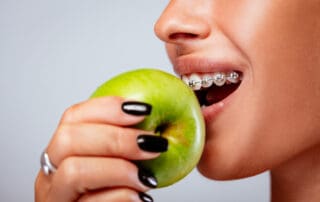 Happy patient cheerfully biting into an apple while wearing braces on her teeth.