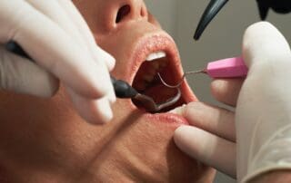 Patient receiving dental treatment with wide open mouth, surrounded by multiple dental instruments.
