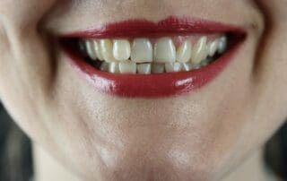 Woman displaying her clean, white teeth.