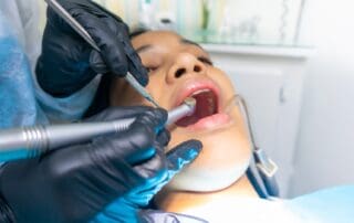 Patient posing with dental cleaning instrument in mouth.