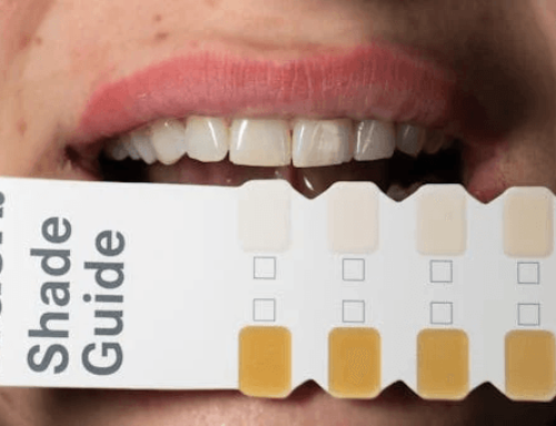 Common Myths About Teeth Whitening: What Really Works for a Brighter Smile